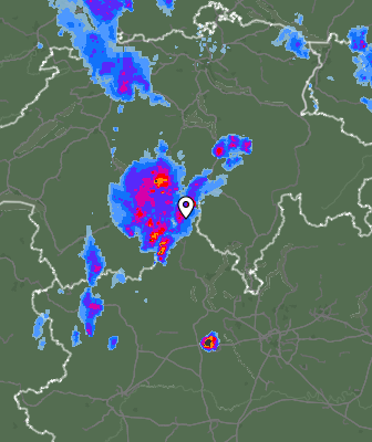 Radar