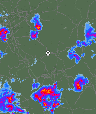 Radar