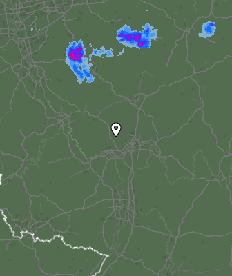 Radar