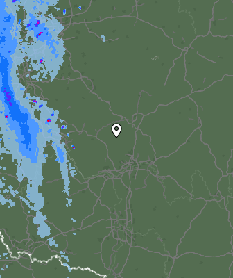 Radar