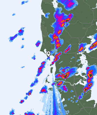 Radar