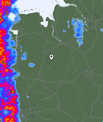 Radar