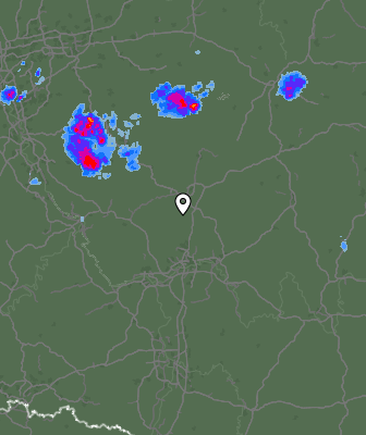 Radar