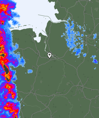 Radar