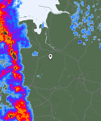 Radar