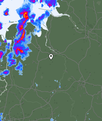 Radar