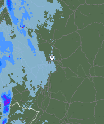 Radar
