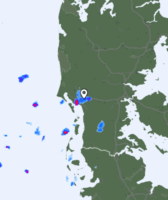 Radar