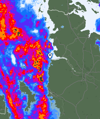 Radar