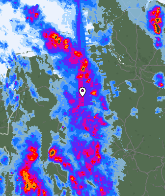 Radar