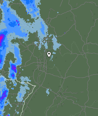 Radar