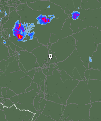 Radar
