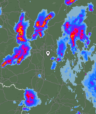 Radar