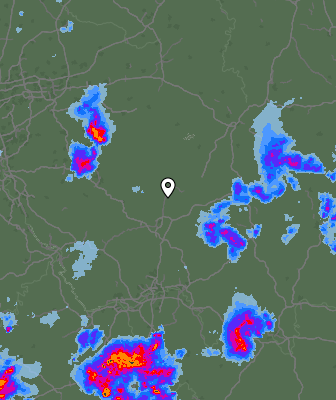 Radar
