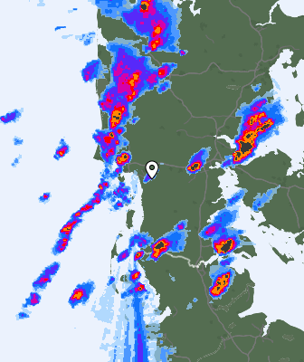 Radar