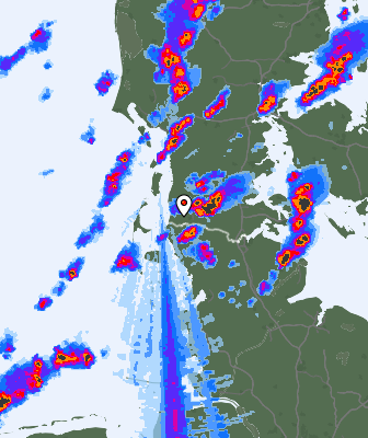 Radar