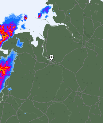 Radar