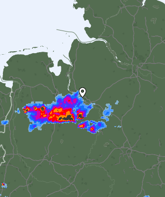 Radar