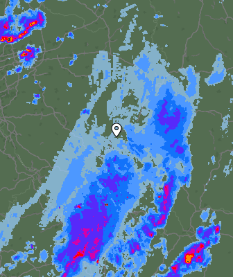 Radar
