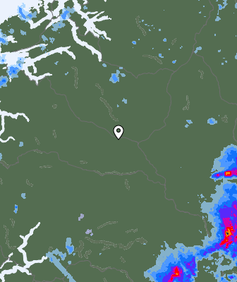 Radar