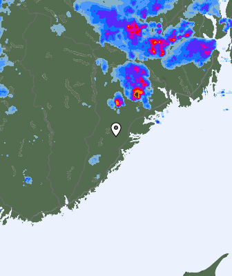 Radar