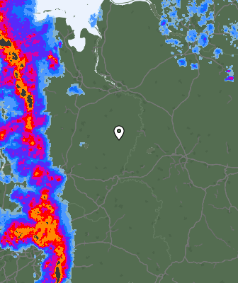Radar