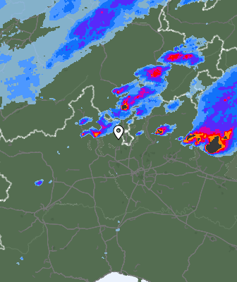 Radar