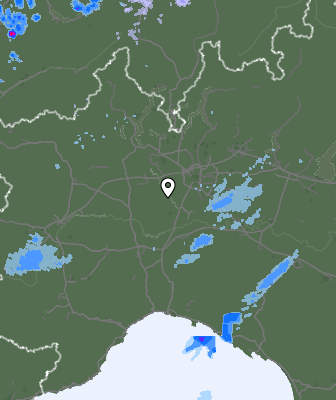 Radar