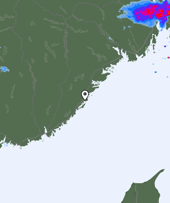 Radar