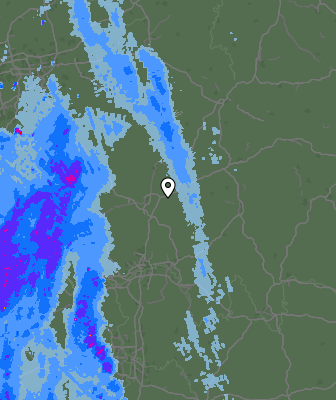 Radar