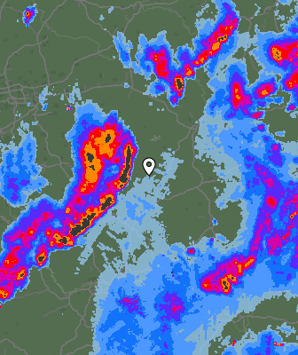 Radar