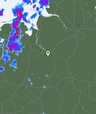 Radar