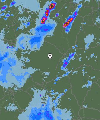 Radar