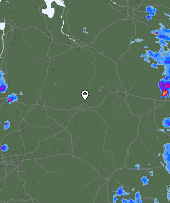 Radar