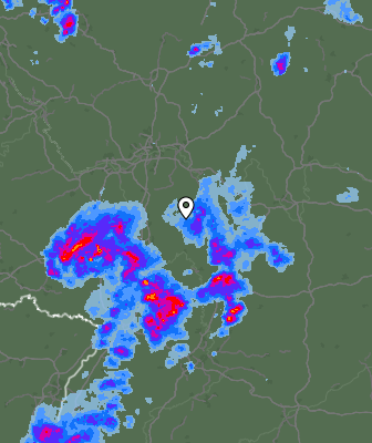 Radar