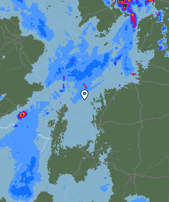 Radar