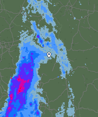 Radar