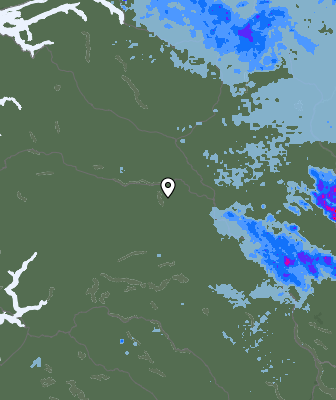 Radar