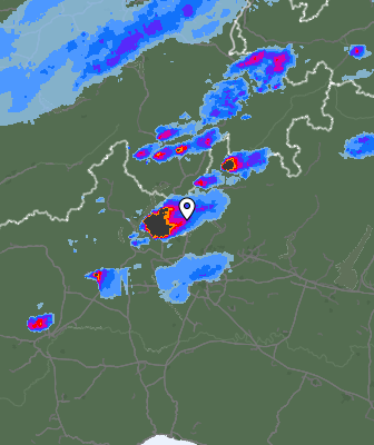 Radar