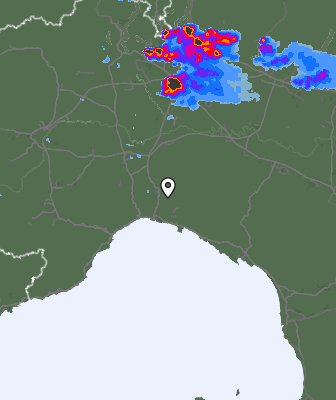 Radar