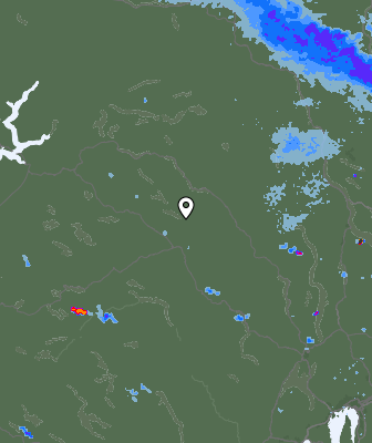 Radar
