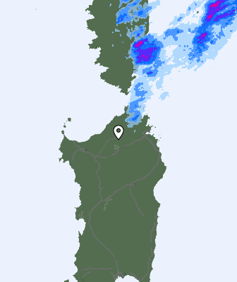 Radar