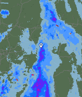 Radar