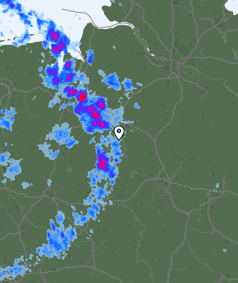 Radar