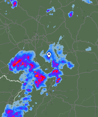 Radar