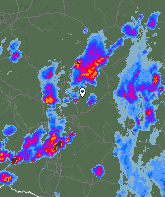 Radar