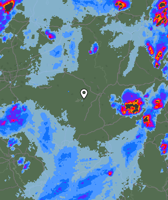 Radar