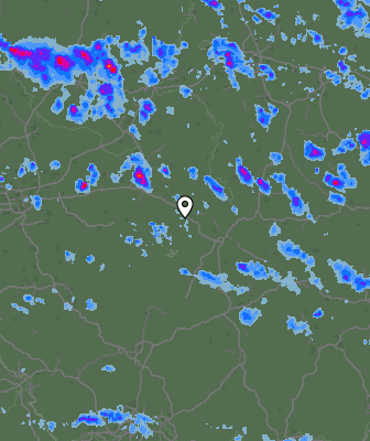 Radar