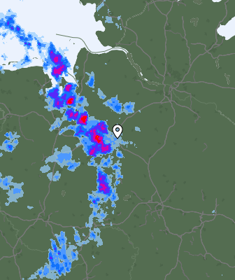 Radar
