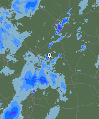 Radar